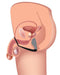 Explorer II Prostate Stimulator & Cock Ring Black | SexToy.com